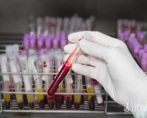 少弱畸形精子症可以做试管婴儿吗?费用包含哪些!