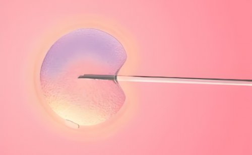 合并代谢异常的PCOS患者如何提高妊娠成功率?